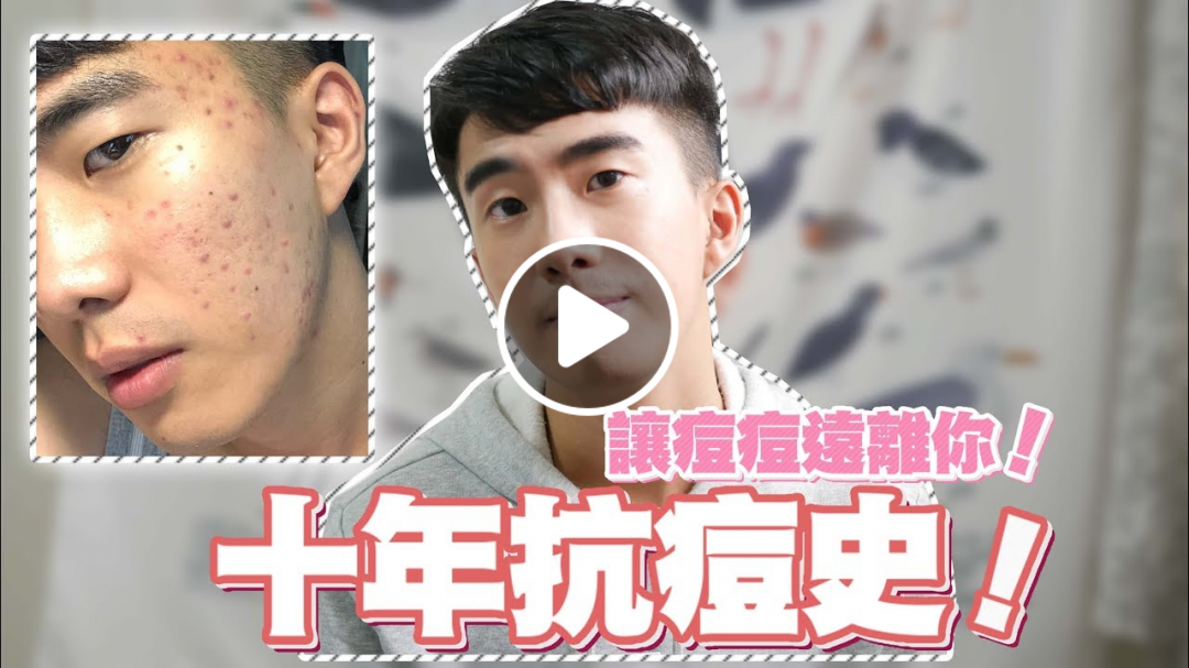 十年抗痘史，痘痘遠離我！推薦台北皮膚科診所及各種抗痘方法！ | SHIN LI