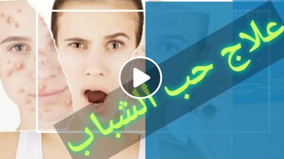 علاج حب الشباب بقناع النشا و ماء الورد | وصفات طبيعية | دكتور عمرو سيف